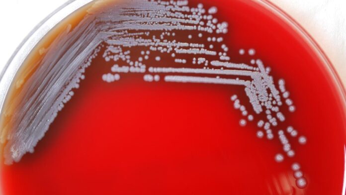Environmental mapping reveals melioidosis in Odisha peak during monsoon